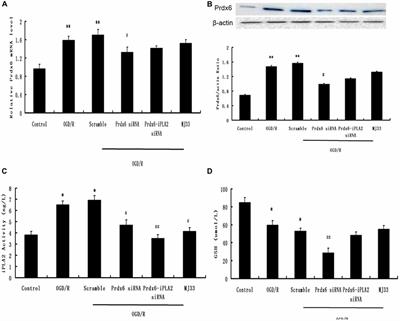 Phospholipase A2 of Peroxiredoxin 6 Plays a Critical Role in Cerebral Ischemia/Reperfusion Inflammatory Injury